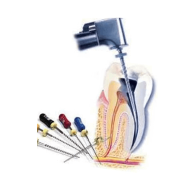Rotary Endodontics